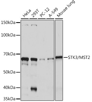 Western blot analysis of various lysates using STK3/MST2 Rabbit mAb at 1:1000 dilution.|Secondary antibody: HRP-conjugated Goat anti-Rabbit IgG (H+L) at 1:10000 dilution.|Lysates/proteins: 25μg per lane.|Blocking buffer: 3% nonfat dry milk in TBST.|Detection: ECL Basic Kit.|Exposure time: 1s.