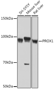 Western blot analysis of various lysates using PROX1 Rabbit mAb at 1:1000 dilution.|Secondary antibody: HRP-conjugated Goat anti-Rabbit IgG (H+L) at 1:10000 dilution.|Lysates/proteins: 25μg per lane.|Blocking buffer: 3% nonfat dry milk in TBST.|Detection: ECL Basic Kit.|Exposure time: 60s.