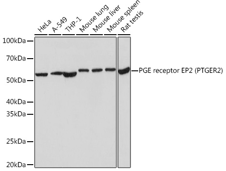 Western blot analysis of various lysates using PGE receptor EP2 (PTGER2) Rabbit mAb at 1:1000 dilution incubated overnight at 4°C.|Secondary antibody: HRP-conjugated Goat anti-Rabbit IgG (H+L) at 1:10000 dilution.|Lysates/proteins: 25 μg per lane.|Blocking buffer: 3% nonfat dry milk in TBST.|Detection: ECL Basic Kit.|Exposure time: 3 s.