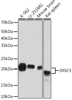 Western blot analysis of various lysates using SRSF3 Rabbit mAb at 1:1000 dilution.|Secondary antibody: HRP-conjugated Goat anti-Rabbit IgG (H+L) at 1:10000 dilution.|Lysates/proteins: 25μg per lane.|Blocking buffer: 3% nonfat dry milk in TBST.|Detection: ECL Basic Kit.|Exposure time: 10s.