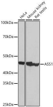 Western blot analysis of various lysates using ASS1 Rabbit mAb at 1:1000 dilution incubated overnight at 4℃.|Secondary antibody: HRP-conjugated Goat anti-Rabbit IgG (H+L) at 1:10000 dilution.|Lysates/proteins: 25 μg per lane.|Blocking buffer: 3% nonfat dry milk in TBST.|Detection: ECL Basic Kit.|Exposure time: 1 s.
