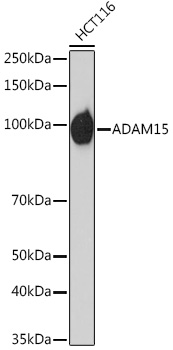 Western blot analysis of lysates from HCT116 cells, using ADAM15 Rabbit mAb at 1:1000 dilution.|Secondary antibody: HRP-conjugated Goat anti-Rabbit IgG (H+L) at 1:10000 dilution.|Lysates/proteins: 25μg per lane.|Blocking buffer: 3% nonfat dry milk in TBST.|Detection: ECL Basic Kit.|Exposure time: 60s.