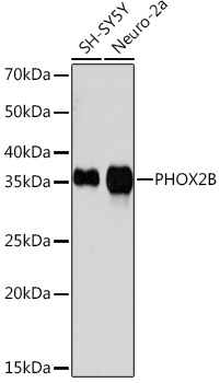 Western blot analysis of various lysates using PHOX2B Rabbit mAb at 1:1000 dilution.|Secondary antibody: HRP-conjugated Goat anti-Rabbit IgG (H+L) at 1:10000 dilution.|Lysates/proteins: 25μg per lane.|Blocking buffer: 3% nonfat dry milk in TBST.|Detection: ECL Basic Kit.|Exposure time: 3min.