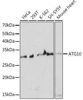 Western blot analysis of various lysates using ATG10 Rabbit mAb at 1:1000 dilution.|Secondary antibody: HRP-conjugated Goat anti-Rabbit IgG (H+L) at 1:10000 dilution.|Lysates/proteins: 25μg per lane.|Blocking buffer: 3% nonfat dry milk in TBST.|Detection: ECL Basic Kit.|Exposure time: 3min.