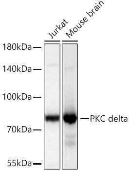 Western blot analysis of various lysates using PKC delta Rabbit mAb at 1:1000 dilution incubated at room temperature for 1.5 hours.|Secondary antibody: HRP-conjugated Goat anti-Rabbit IgG (H+L) at 1:10000 dilution.|Lysates/proteins: 25 μg per lane.|Blocking buffer: 3% nonfat dry milk in TBST.|Detection: ECL Basic Kit.|Exposure time: 5 s.