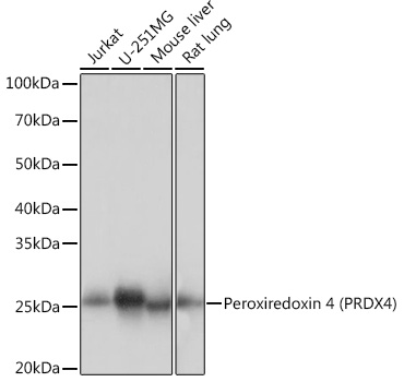 Western blot analysis of various lysates using Peroxiredoxin 4 (PRDX4) Rabbit mAb at 1:1000 dilution.|Secondary antibody: HRP-conjugated Goat anti-Rabbit IgG (H+L) at 1:10000 dilution.|Lysates/proteins: 25μg per lane.|Blocking buffer: 3% nonfat dry milk in TBST.|Detection: ECL Basic Kit.|Exposure time: 3s.