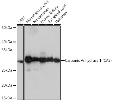 Western blot analysis of various lysates using Carbonic Anhydrase 2 (CA2) Rabbit mAb at 1:1000 dilution.|Secondary antibody: HRP-conjugated Goat anti-Rabbit IgG (H+L) at 1:10000 dilution.|Lysates/proteins: 25μg per lane.|Blocking buffer: 3% nonfat dry milk in TBST.|Detection: ECL Basic Kit.|Exposure time: 3s.