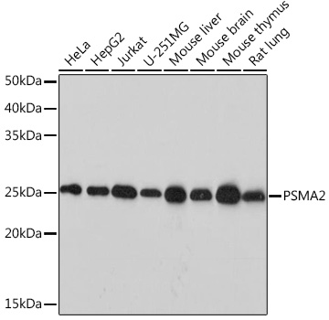 Western blot analysis of various lysates, using PSMA2 Rabbit mAb at 1:1000 dilution.|Secondary antibody: HRP-conjugated Goat anti-Rabbit IgG (H+L) at 1:10000 dilution.|Lysates/proteins: 25μg per lane.|Blocking buffer: 3% nonfat dry milk in TBST.|Detection: ECL Basic Kit.|Exposure time: 10s.