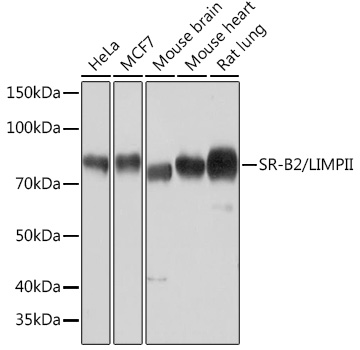 Western blot analysis of various lysates using SR-B2/SR-B2/LIMPII Rabbit mAb at 1:1000 dilution.|Secondary antibody: HRP-conjugated Goat anti-Rabbit IgG (H+L) at 1:10000 dilution.|Lysates/proteins: 25μg per lane.|Blocking buffer: 3% nonfat dry milk in TBST.|Detection: ECL Basic Kit.|Exposure time: 10s.