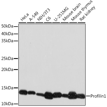 Western blot analysis of various lysates using Profilin1 Rabbit mAb at 1:1000 dilution.|Secondary antibody: HRP-conjugated Goat anti-Rabbit IgG (H+L) at 1:10000 dilution.|Lysates/proteins: 25μg per lane.|Blocking buffer: 3% nonfat dry milk in TBST.|Detection: ECL Basic Kit.|Exposure time: 30s.