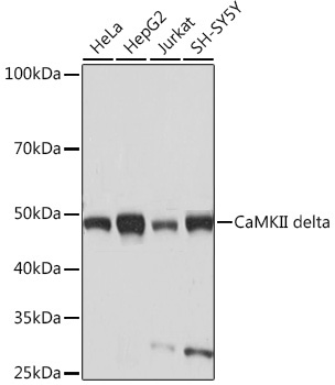 Western blot analysis of various lysates using CaMKII delta Rabbit mAb at 1:1000 dilution.|Secondary antibody: HRP-conjugated Goat anti-Rabbit IgG (H+L) at 1:10000 dilution.|Lysates/proteins: 25μg per lane.|Blocking buffer: 3% nonfat dry milk in TBST.|Detection: ECL Basic Kit.|Exposure time: 10s.