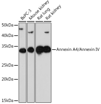 Western blot analysis of various lysates using Annexin A4/Annexin IV Rabbit mAb at 1:1000 dilution.|Secondary antibody: HRP-conjugated Goat anti-Rabbit IgG (H+L) at 1:10000 dilution.|Lysates/proteins: 25μg per lane.|Blocking buffer: 3% nonfat dry milk in TBST.|Detection: ECL Enhanced Kit.|Exposure time: 3min.