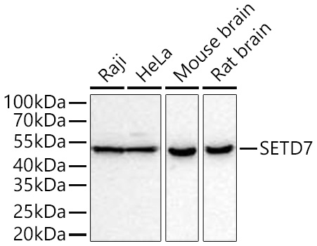 Western blot analysis of various lysates using SETD7 Rabbit mAb at 1:1000 dilution incubated at room temperature for 1.5 hours.|Secondary antibody: HRP-conjugated Goat anti-Rabbit IgG (H+L) at 1:10000 dilution.|Lysates/proteins: 25 μg per lane.|Blocking buffer: 3% nonfat dry milk in TBST.|Detection: ECL Basic Kit.|Exposure time: 90 s.
