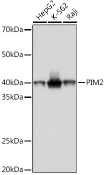 Western blot analysis of various lysates using PIM2 Rabbit mAb at 1:1000 dilution.|Secondary antibody: HRP-conjugated Goat anti-Rabbit IgG (H+L) at 1:10000 dilution.|Lysates/proteins: 25μg per lane.|Blocking buffer: 3% nonfat dry milk in TBST.|Detection: ECL Basic Kit.|Exposure time: 1s.