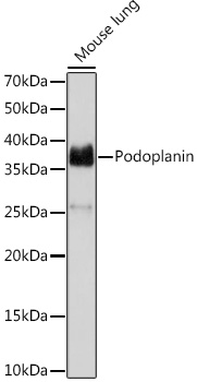 Western blot analysis of lysates from Mouse lung, using Podoplanin Rabbit mAb at 1:1000 dilution.|Secondary antibody: HRP-conjugated Goat anti-Rabbit IgG (H+L) at 1:10000 dilution.|Lysates/proteins: 25μg per lane.|Blocking buffer: 3% nonfat dry milk in TBST.|Detection: ECL Basic Kit.|Exposure time: 30s.
