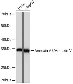 Western blot analysis of various lysates using Annexin A5/Annexin A5/Annexin V Rabbit mAb at 1:1000 dilution.|Secondary antibody: HRP-conjugated Goat anti-Rabbit IgG (H+L) at 1:10000 dilution.|Lysates/proteins: 25μg per lane.|Blocking buffer: 3% nonfat dry milk in TBST.|Detection: ECL Basic Kit.|Exposure time: 1s.