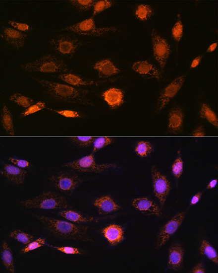 Immunofluorescence analysis of NIH-3T3 cells using CAMKIV Rabbit mAb at dilution of 1:100 (40x lens). Secondary antibody: Cy3-conjugated Goat anti-Rabbit IgG (H+L) at 1:500 dilution. Blue: DAPI for nuclear staining.