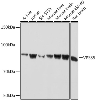 Western blot analysis of various lysates using VPS35 Rabbit mAb at 1:1000 dilution.|Secondary antibody: HRP-conjugated Goat anti-Rabbit IgG (H+L) at 1:10000 dilution.|Lysates/proteins: 25μg per lane.|Blocking buffer: 3% nonfat dry milk in TBST.|Detection: ECL Basic Kit.|Exposure time: 30s.
