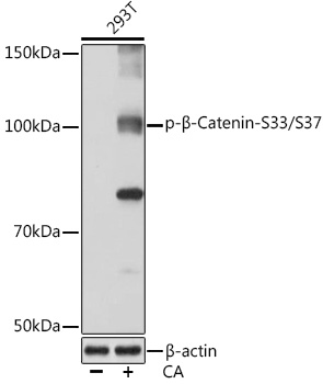 Western blot analysis of lysates from 293T cells, using Phospho-β-Catenin-S33/S37 Rabbit mAb at 1:1000 dilution. 293T cells were treated with Calyculin A (100 nM) at 37℃ for 30 minutes after serum-starvation overnight.|Secondary antibody: HRP-conjugated Goat anti-Rabbit IgG (H+L) at 1:10000 dilution.|Lysates/proteins: 25μg per lane.|Blocking buffer: 3% BSA.|Detection: ECL Basic Kit.|Exposure time: 3min.