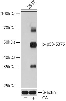 Western blot analysis of lysates from 293T cells, using Phospho-p53-S376 Rabbit mAb at 1:1000 dilution. 293T cells were treated with Calyculin A (100 nM) at 37℃ for 30 minutes after serum-starvation overnight.|Secondary antibody: HRP-conjugated Goat anti-Rabbit IgG (H+L) at 1:10000 dilution.|Lysates/proteins: 25μg per lane.|Blocking buffer: 3% BSA.|Detection: ECL Basic Kit.|Exposure time: 1s.