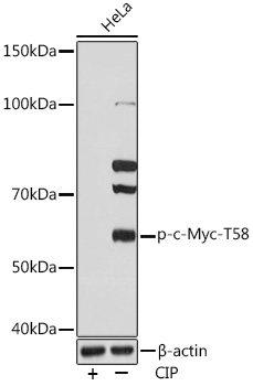 Western blot analysis of lysates from HeLa cells, using Phospho-c-Myc-T58 Rabbit mAb at 1:1000 dilution. Hela cells were treated by CIP(20uL/400ul) at 37℃ for 1 hour.|Secondary antibody: HRP-conjugated Goat anti-Rabbit IgG (H+L) at 1:10000 dilution.|Lysates/proteins: 25μg per lane.|Blocking buffer: 3% BSA.|Detection: ECL Basic Kit.|Exposure time: 10s.