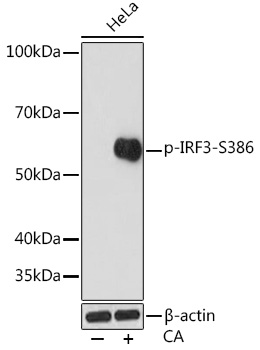 Western blot analysis of lysates from HeLa cells, using Phospho-IRF3-S386 Rabbit mAb at 1:1000 dilution. HeLa cells were treated with Calyculin A (100 nM) at 37℃ for 30 minutes after serum-starvation overnight.|Secondary antibody: HRP-conjugated Goat anti-Rabbit IgG (H+L) at 1:10000 dilution.|Lysates/proteins: 25μg per lane.|Blocking buffer: 3% BSA.|Detection: ECL Enhanced Kit.|Exposure time: 3min.