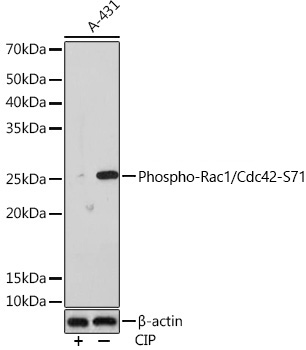Western blot analysis of lysates from A-431 cells, using Phospho-Rac1/Cdc42-S71 Rabbit mAb at 1:1000 dilution. A-431 cells were treated by CIP(20uL/400ul) at 37℃ for 1 hour.|Secondary antibody: HRP-conjugated Goat anti-Rabbit IgG (H+L) at 1:10000 dilution.|Lysates/proteins: 25μg per lane.|Blocking buffer: 3% BSA.|Detection: ECL Enhanced Kit.|Exposure time: 3min.
