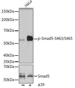 Western blot analysis of lysates from HeLa cells, using Phospho-Smad5-S463/S465 Rabbit mAb at 1:1000 dilution or Smad5 antibody. Hela cells were treated with ATP(5 mM) at 30℃ for 1 hour.|Secondary antibody: HRP-conjugated Goat anti-Rabbit IgG (H+L) at 1:10000 dilution.|Lysates/proteins: 25μg per lane.|Blocking buffer: 3% BSA.|Detection: ECL Basic Kit.|Exposure time: 3min.