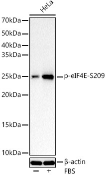 Western blot analysis of lysates from HeLa cells, using Phospho-eIF4E-S209 Rabbit mAb at  1:1000 dilution. HeLa cells were treated with 20% FBS at 37℃ for 30 minutes after serum-starvation overnight.|Secondary antibody: HRP-conjugated Goat anti-Rabbit IgG (H+L) at 1:10000 dilution.|Lysates/proteins: 25 μg per lane.|Blocking buffer: 3% nonfat dry milk in TBST.|Detection: ECL Basic Kit.|Exposure time: 3 s.
