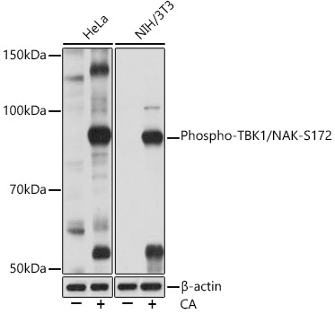 Western blot analysis of various lysates using Phospho-TBK1/NAK-S172 Rabbit mAb at 1:1000 dilution. Both HeLa cells and NIH/3T3 cells were treated with Calyculin A (100 nM) at 37℃ for 30 minutes after serum-starvation overnight.|Secondary antibody: HRP-conjugated Goat anti-Rabbit IgG (H+L) at 1:10000 dilution.|Lysates/proteins: 25μg per lane.|Blocking buffer: 3% BSA.|Detection: ECL Basic Kit.|Exposure time: 1min.