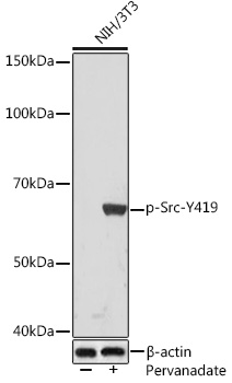 Western blot analysis of lysates from NIH/3T3 cells, using Phospho-Src-Y419 Rabbit mAb at 1:1000 dilution. NIH/3T3 cells were treated with pervanadate (1 mM) at 37℃ for 30 minutes after serum-starvation overnight.|Secondary antibody: HRP-conjugated Goat anti-Rabbit IgG (H+L) at 1:10000 dilution.|Lysates/proteins: 25μg per lane.|Blocking buffer: 3% BSA.|Detection: ECL Basic Kit.|Exposure time: 3min.