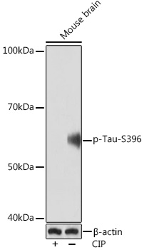 Western blot analysis of lysates from Mouse brain, using Phospho-Tau-S396 Rabbit mAb at 1:1000 dilution. Mouse brain were treated by CIP(20μL/400μL) at 37℃ for 1 hour.|Secondary antibody: HRP-conjugated Goat anti-Rabbit IgG (H+L) at 1:10000 dilution.|Lysates/proteins: 25μg  per lane.|Blocking buffer: 3% BSA.|Detection: ECL Basic Kit.|Exposure time: 90s.