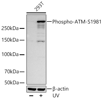 Western blot analysis of lysates from 293T cells using Phospho-ATM-S1981 Rabbit mAb at 1:8000 dilution incubated overnight at 4℃. 293T cells were treated with UV at room temperature for 15-30 minutes.|Secondary antibody: HRP-conjugated Goat anti-Rabbit IgG (H+L) at 1:10000 dilution.|Lysates/proteins: 30 μg per lane.| Blocking buffer: 3 % nonfat dry milk in TBST.| Detection: ECL Basic Kit.| Exposure time: 45s.