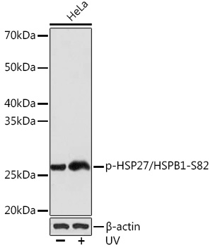 Western blot analysis of lysates from HeLa cells, using Phospho-HSP27/HSPB1-S82 Rabbit mAb at 1:1000 dilution. HeLa cells were treated with UV at room temperature for 15-30 minutes.|Secondary antibody: HRP-conjugated Goat anti-Rabbit IgG (H+L) at 1:10000 dilution.|Lysates/proteins: 25μg per lane.|Blocking buffer: 3% BSA.|Detection: ECL Basic Kit.|Exposure time: 3s.