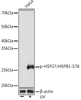 Western blot analysis of lysates from HeLa cells, using Phospho-HSP27/HSPB1-S78 Rabbit mAb at 1:1000 dilution. HeLa cells were treated with UV at room temperature for 15-30 minutes.|Secondary antibody: HRP-conjugated Goat anti-Rabbit IgG (H+L) at 1:10000 dilution.|Lysates/proteins: 25μg per lane.|Blocking buffer: 3% BSA.|Detection: ECL Basic Kit.|Exposure time: 3s.