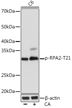 Western blot analysis of lysates from C6 cells, using Phospho-RPA2-T21 Rabbit mAb at 1:1000 dilution. C6 cells were treated with Calyculin A (100 nM) at 37℃ for 30 minutes after serum-starvation overnight.|Secondary antibody: HRP-conjugated Goat anti-Rabbit IgG (H+L) at 1:10000 dilution.|Lysates/proteins: 25μg per lane.|Blocking buffer: 3% BSA.|Detection: ECL Basic Kit.|Exposure time: 10s.
