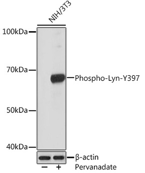 Western blot analysis of lysates from NIH/3T3 cells, using Phospho-Lyn-Y397 Rabbit mAb at 1:1000 dilution. NIH/3T3 cells were treated with pervanadate (1 mM) at 37℃ for 30 minutes after serum-starvation overnight.|Secondary antibody: HRP-conjugated Goat anti-Rabbit IgG (H+L) at 1:10000 dilution.|Lysates/proteins: 25μg per lane.|Blocking buffer: 3% BSA.|Detection: ECL Basic Kit.|Exposure time: 30s.