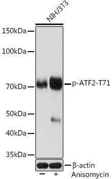 Western blot analysis of lysates from NIH/3T3 cells, using Phospho-ATF2-T71 Rabbit mAb at 1:1000 dilution. NIH/3T3 cells were treated with Anisomycin (25 μg/mL) at 37℃ for 30 minutes.|Secondary antibody: HRP-conjugated Goat anti-Rabbit IgG (H+L) at 1:10000 dilution.|Lysates/proteins: 25μg per lane.|Blocking buffer: 3% BSA.|Detection: ECL Basic Kit.|Exposure time: 3s.