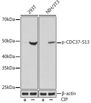 Western blot analysis of various lysates using Phospho-CDC37-S13 Rabbit mAb at 1:1000 dilution. Both 293T cells and NIH/3T3 cells were treated by CIP(20uL/400ul) at 37℃ for 1 hour.|Secondary antibody: HRP-conjugated Goat anti-Rabbit IgG (H+L) at 1:10000 dilution.|Lysates/proteins: 25μg per lane.|Blocking buffer: 3% BSA.|Detection: ECL Basic Kit.|Exposure time: 10s.