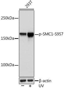 Western blot analysis of lysates from 293T cells, using Phospho-SMC1-S957 Rabbit mAb at 1:1000 dilution. 293T cells were treated with UV at room temperature for 15-30 minutes.|Secondary antibody: HRP-conjugated Goat anti-Rabbit IgG (H+L) at 1:10000 dilution.|Lysates/proteins: 25μg per lane.|Blocking buffer: 3% BSA.|Detection: ECL Basic Kit.|Exposure time: 1s.