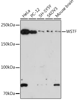 Western blot analysis of various lysates using WSTF Rabbit mAb (A9519) at 1:1000 dilution.|Secondary antibody: HRP-conjugated Goat anti-Rabbit IgG (H+L) (AS014) at 1:10000 dilution.|Lysates/proteins: 25μg per lane.|Blocking buffer: 3% nonfat dry milk in TBST.|Detection: ECL Basic Kit (RM00020).|Exposure time: 180s.