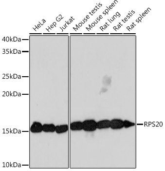 Western blot analysis of various lysates using RPS20 Rabbit mAb at 1:1000 dilution.|Secondary antibody: HRP-conjugated Goat anti-Rabbit IgG (H+L) at 1:10000 dilution.|Lysates/proteins: 25μg per lane.|Blocking buffer: 3% nonfat dry milk in TBST.|Detection: ECL Basic Kit.|Exposure time: 3min.