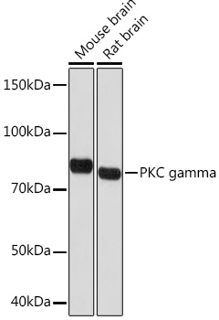 Western blot analysis of various lysates using PKC gamma Rabbit mAb at 1:1000 dilution.|Secondary antibody: HRP-conjugated Goat anti-Rabbit IgG (H+L) at 1:10000 dilution.|Lysates/proteins: 25μg per lane.|Blocking buffer: 3% nonfat dry milk in TBST.|Detection: ECL Basic Kit.|Exposure time: 10s.