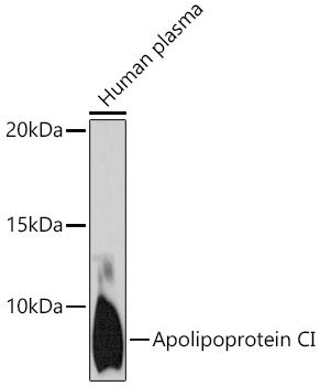 Western blot analysis of lysates from human plasma, using  at 1:1000 dilution.|Secondary antibody: HRP-conjugated Goat anti-Rabbit IgG (H+L) at 1:10000 dilution.|Lysates/proteins: 25μg per lane.|Blocking buffer: 3% nonfat dry milk in TBST.|Detection: ECL Enhanced Kit.|Exposure time: 180s.