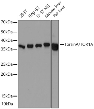 Western blot analysis of various lysates using TorsinA/TOR1A Rabbit mAb (A9579) at 1:500 dilution incubated at room temperature for 1.5 hours.|Secondary antibody: HRP-conjugated Goat anti-Rabbit IgG (H+L) (AS014) at 1:10000 dilution.|Lysates/proteins: 25 μg per lane.|Blocking buffer: 3% nonfat dry milk in TBST.|Detection: ECL Basic Kit (RM00020).|Exposure time: 60s.