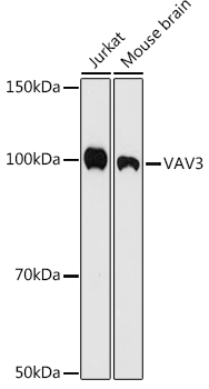 Western blot analysis of various lysates using VAV3 Rabbit mAb (A9583) at 1:500 dilution.|Secondary antibody: HRP-conjugated Goat anti-Rabbit IgG (H+L) (AS014) at 1:10000 dilution.|Lysates/proteins: 25μg per lane.|Blocking buffer: 3% nonfat dry milk in TBST.|Detection: ECL Enhanced Kit (RM00021).|Exposure time: 180s.