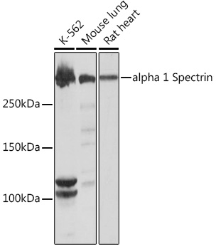 Western blot analysis of various lysates using alpha 1 Spectrin Rabbit mAb at 1:1000 dilution.|Secondary antibody: HRP-conjugated Goat anti-Rabbit IgG (H+L) at 1:10000 dilution.|Lysates/proteins: 25μg per lane.|Blocking buffer: 3% nonfat dry milk in TBST.|Detection: ECL Basic Kit.|Exposure time: 10s.