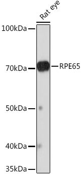 Western blot analysis of lysates from Rat eye, using RPE65 Rabbit mAb at 1:1000 dilution.|Secondary antibody: HRP-conjugated Goat anti-Rabbit IgG (H+L) at 1:10000 dilution.|Lysates/proteins: 25μg per lane.|Blocking buffer: 3% nonfat dry milk in TBST.|Detection: ECL Basic Kit.|Exposure time: 3min.