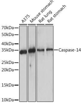 Western blot analysis of various lysates using Caspase-14 Rabbit mAb at 1:1000 dilution incubated overnight at 4°C.|Secondary antibody: HRP-conjugated Goat anti-Rabbit IgG (H+L) at 1:10000 dilution.|Lysates/proteins: 25 μg per lane.|Blocking buffer: 3% nonfat dry milk in TBST.|Detection: ECL Enhanced Kit.|Exposure time: 10 s.