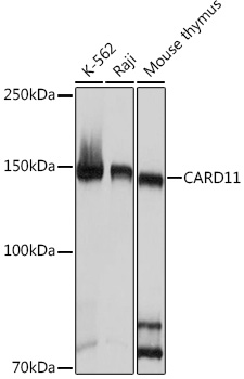 Western blot analysis of various lysates using CARD11 Rabbit mAb at 1:1000 dilution.|Secondary antibody: HRP-conjugated Goat anti-Rabbit IgG (H+L) at 1:10000 dilution.|Lysates/proteins: 25μg per lane.|Blocking buffer: 3% nonfat dry milk in TBST.|Detection: ECL Basic Kit.|Exposure time: 1s.